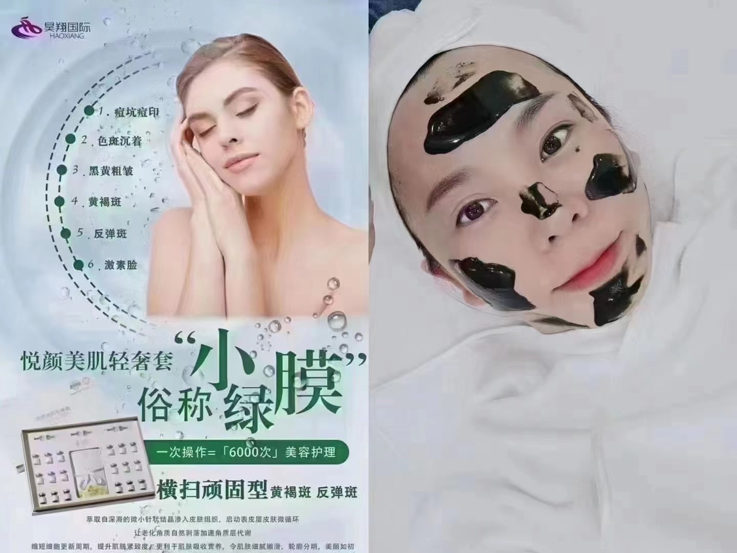 海绵微针的功效你知道多少？